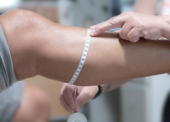 Steunkousen aanmeten Haarlem